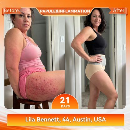 𝐎𝐟𝐟𝐢𝐜𝐢𝐚𝐥 𝐁𝐫𝐚𝐧𝐝 𝐒𝐭𝐨𝐫𝐞 | 𝐏𝐀𝐔𝐑𝐀𝐉𝐔® 🔥 𝟐𝟎𝟐𝟔 𝐌𝐨𝐫𝐢𝐧𝐠𝐚 & 𝐁𝐞𝐫𝐛𝐞𝐫𝐢𝐧𝐞 𝟒-𝐈𝐧-𝟏 𝐌𝐢𝐜𝐫𝐨-𝐏𝐚𝐫𝐭𝐢𝐜𝐥𝐞 𝐒𝐜𝐮𝐥𝐩𝐭𝐢𝐧𝐠 & 𝐅𝐚𝐭-𝐁𝐮𝐫𝐧 𝐒𝐡𝐨𝐫𝐭𝐬 🎉