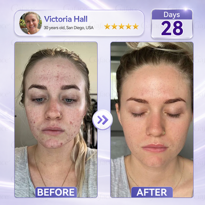 🎁 Only 10 left! ✨ 𝐆𝐚𝐟𝐚𝐜𝐞® Collagen & Fullerene Roller Firming Cream 💚 Enjoy 30% OFF today! Many customers choose 4–6 jars for a complete firming skincare routine. Don't miss out before stock runs out! 🎁