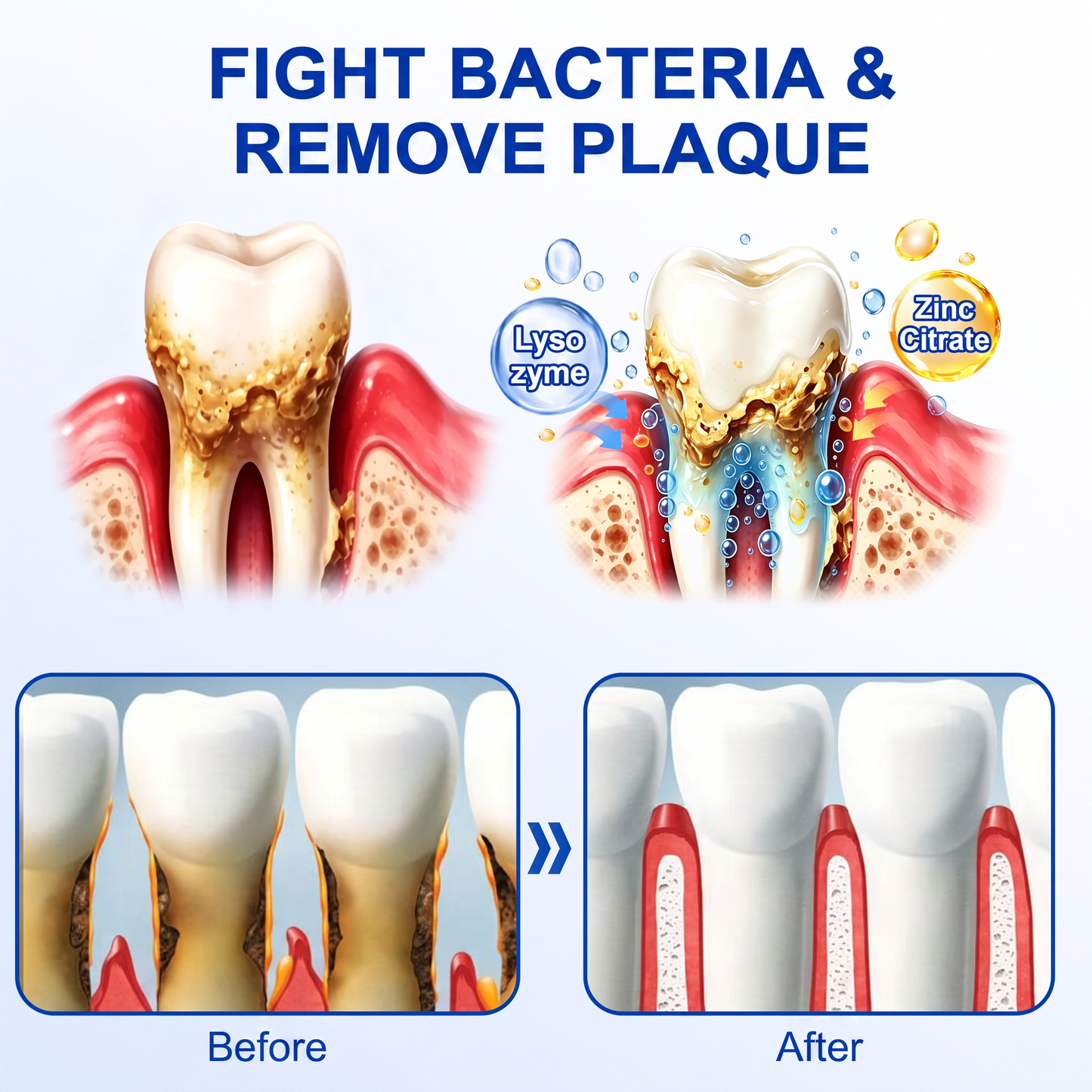 Glimmerly®👀GumRevive periodontal repair gel