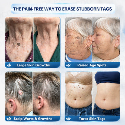𝐎𝐟𝐟𝐢𝐜𝐢𝐚𝐥 𝐁𝐫𝐚𝐧𝐝 𝐒𝐭𝐨𝐫𝐞 💎 | 𝐏𝐢𝐜𝐝𝐨® 7-𝐃𝐚𝐲 𝐒𝐤𝐢𝐧 𝐓𝐚𝐠 & 𝐒𝐩𝐨𝐭 𝐄𝐫𝐚𝐬𝐞𝐫 𝐂𝐫𝐞𝐚𝐦  (Zero Pain, Zero 𝐒𝐜𝐚𝐫𝐬 Formula)  💎