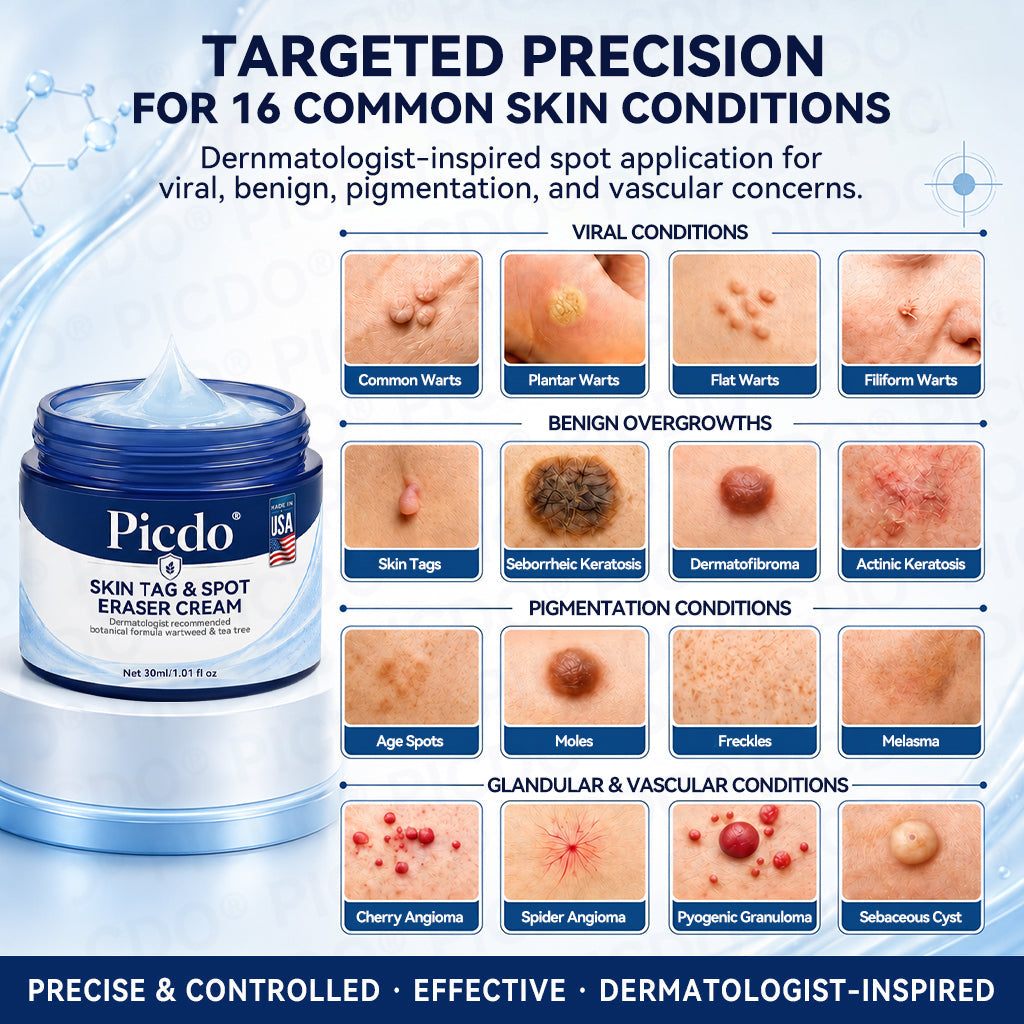 𝐎𝐟𝐟𝐢𝐜𝐢𝐚𝐥 𝐁𝐫𝐚𝐧𝐝 𝐒𝐭𝐨𝐫𝐞 💎 | 𝐏𝐢𝐜𝐝𝐨® 7-𝐃𝐚𝐲 𝐒𝐤𝐢𝐧 𝐓𝐚𝐠 & 𝐒𝐩𝐨𝐭 𝐄𝐫𝐚𝐬𝐞𝐫 𝐂𝐫𝐞𝐚𝐦  (Zero Pain, Zero 𝐒𝐜𝐚𝐫𝐬 Formula)  💎