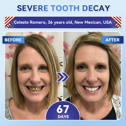 Only 10 boxes left! 🎁 𝐆𝐥𝐢𝐦𝐦𝐞𝐫𝐥𝐲® Enjoy an exclusive 30% off today! Recommended by dentists — 4 to 6 boxes are suggested to activate dental pulp stem cells, promote new dentin growth, and repair cavities. Last chance before the new year — don’t miss out! 🎁