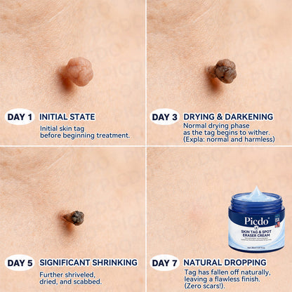 𝐎𝐟𝐟𝐢𝐜𝐢𝐚𝐥 𝐁𝐫𝐚𝐧𝐝 𝐒𝐭𝐨𝐫𝐞 💎 | 𝐏𝐢𝐜𝐝𝐨® 7-𝐃𝐚𝐲 𝐒𝐤𝐢𝐧 𝐓𝐚𝐠 & 𝐒𝐩𝐨𝐭 𝐄𝐫𝐚𝐬𝐞𝐫 𝐂𝐫𝐞𝐚𝐦  (Zero Pain, Zero 𝐒𝐜𝐚𝐫𝐬 Formula)  💎