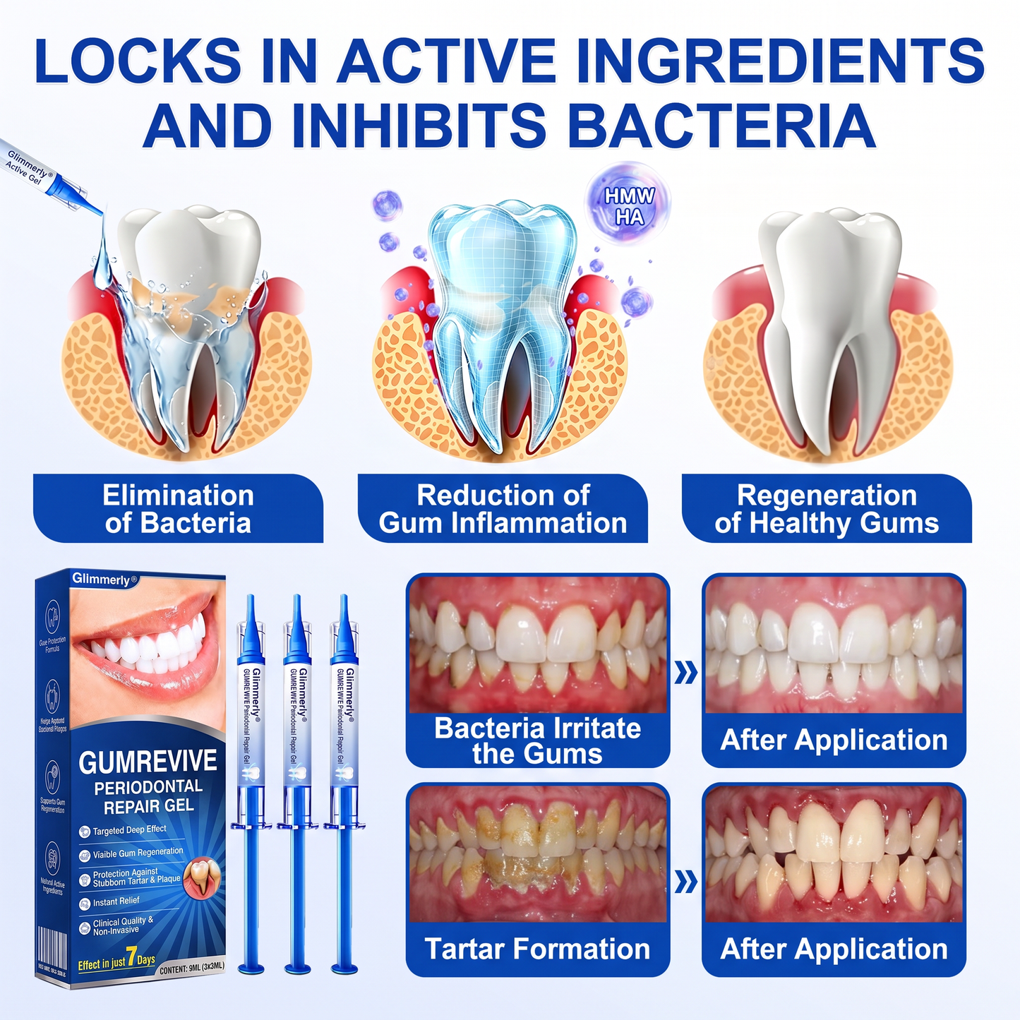Glimmerly®👀GumRevive periodontal repair gel