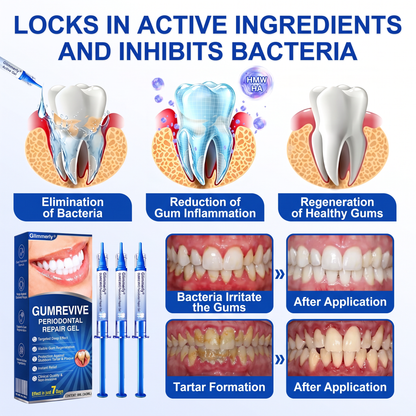 Glimmerly®👀GumRevive periodontal repair gel