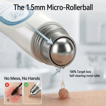 𝐏i𝐜𝐝o® 7-𝐷𝑎𝑦 𝗧𝐚𝐠 & 𝗦𝗽𝐨𝐭 𝐄𝐫𝒂𝒔𝒆𝒓(Zero Pain, Zero 𝐒𝐜𝐚𝒓𝒔 Rollerball) 🔊
